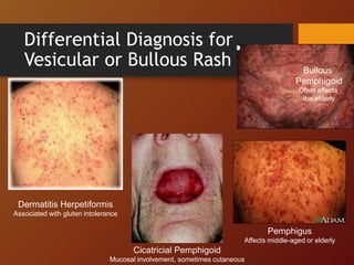 Toxicodermias | PPT