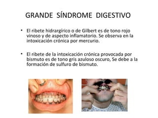 GRANDE SÍNDROME DIGESTIVO
• El ribete hidrargírico o de Gilbert es de tono rojo
  vinoso y de aspecto inflamatorio. Se observa en la
  intoxicación crónica por mercurio.

• El ribete de la intoxicación crónica provocada por
  bismuto es de tono gris azuloso oscuro, Se debe a la
  formación de sulfuro de bismuto.
 