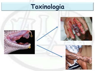 Toxinologia
 