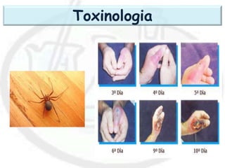 Toxinologia
 