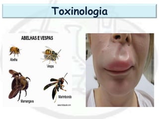 Toxinologia
 