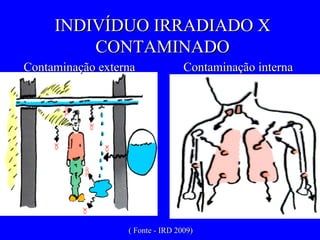 ( Fonte - IRD 2009) INDIVÍDUO IRRADIADO X CONTAMINADO Contaminação externa Contaminação interna 