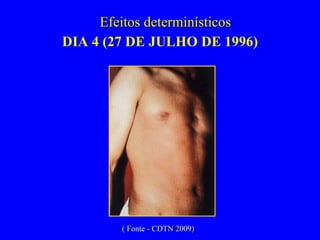 DIA 4 (27 DE JULHO DE 1996) Efeitos determinísticos ( Fonte - CDTN 2009) 