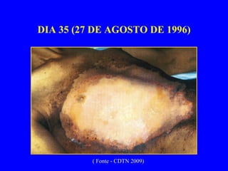 DIA 35 (27 DE AGOSTO DE 1996) ( Fonte - CDTN 2009) 
