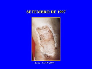 SETEMBRO DE 1997 ( Fonte - CDTN 2009) 