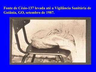 Fonte de Césio-137 levada até a Vigilância Sanitária de Goiânia, GO, setembro de 1987. 