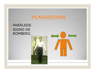 PLAGUICIDASPLAGUICIDAS
 PARÁLISIS
 SIGNO DE
ROMBERG.
 