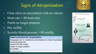 Signs of Atropinization
1. Clear chest on auscultation with no wheeze
2. Heart rate > 80 beats/min
3. Pupils no longer pinpoint
4. Dry axillae
5. Systolic blood pressure > 80 mmHg
 