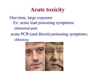 Acute toxicity
One-time, large exposure
Ex: acute lead poisoning symptoms:
abdominal pain
acute PCB (and dioxin) poisoning symptoms:
chloracne
 