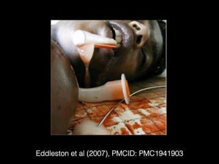 Eddleston et al (2007), PMCID: PMC1941903!
 