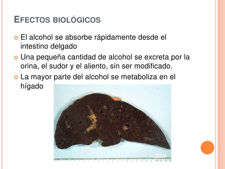 El alcoholismo y vsd
