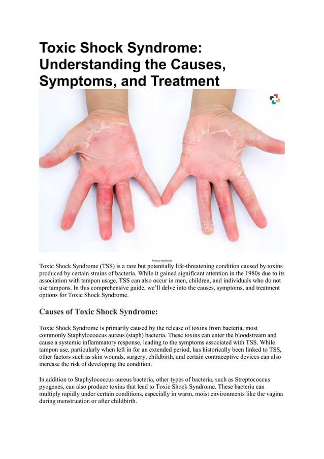 Toxic Shock Syndrome: Causes, Symptoms, and Treatment | The ...