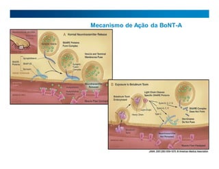 Mecanismo de Ação da BoNT-A
 