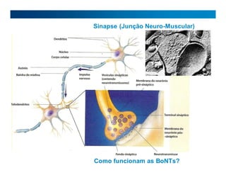 Sinapse (Junção Neuro-Muscular)
Como funcionam as BoNTs?
 