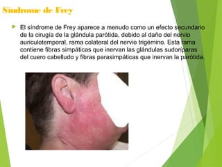 Síndrome de Frey
 El síndrome de Frey aparece a menudo como un efecto secundario
de la cirugía de la glándula parótida, debido al daño del nervio
auriculotemporal, rama colateral del nervio trigémino. Esta rama
contiene fibras simpáticas que inervan las glándulas sudoríparas
del cuero cabelludo y fibras parasimpáticas que inervan la parótida.
 