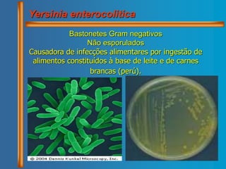 Bastonetes Gram negativos
Não esporulados
Causadora de infecções alimentares por ingestão de
alimentos constituídos à base de leite e de carnes
brancas (perú).
Yersinia enterocolitica
 