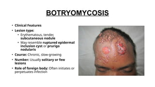 toxin mediated dermatological disease.pptx