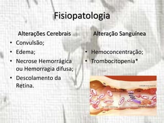 Fisiopatologia
Alterações Cerebrais
• Convulsão;
• Edema;
• Necrose Hemorrágica
ou Hemorragia difusa;
• Descolamento da
Retina.
Alteração Sanguínea
• Hemoconcentração;
• Trombocitopenia*
 