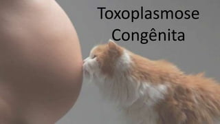 Toxoplasmose
Congênita
 