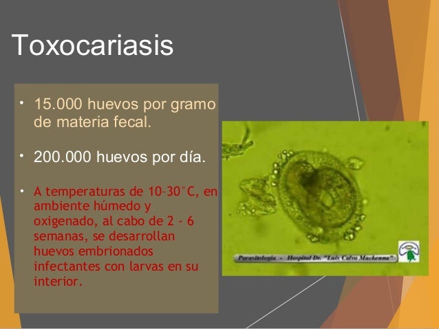 Toxocariasis