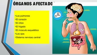 ÓRGANOS AFECTADOS
•Los pulmones
•El corazón
•El riñón
•El hígado
•El músculo esquelético
•Los ojos
•Sistema nervioso central
 