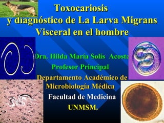 Toxocariosis  y diagnóstico de La Larva Migrans Visceral en el hombre Dra. Hilda María Solís  Acosta Profesor Principal  Departamento Académico de Microbiología Médica   Facultad de Medicina UNMSM. 