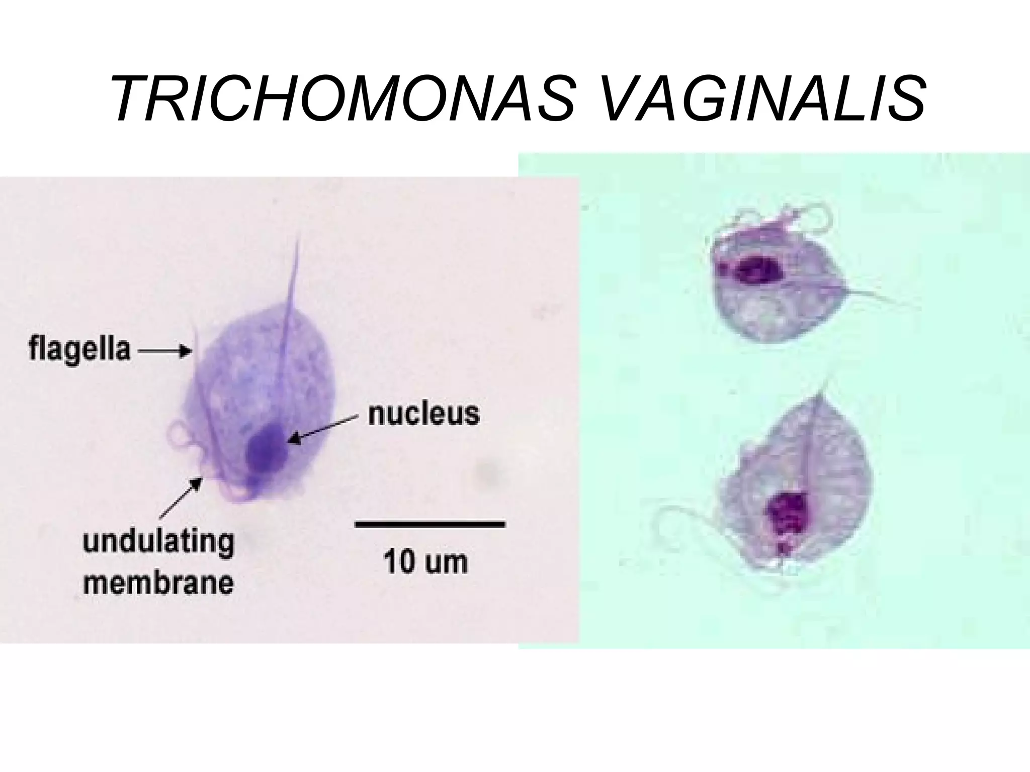 TRICHOMONAS VAGINALIS