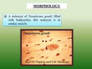  A zoitocyst of Toxoplasma gondii filled
with bradyzoites; this zoitocyst is in
cardiac muscle.
MORPHOLOGY
 