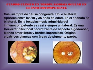 CUADRO CLINICO EN TOXOPLASMOSIS OCULAR EN
EL INMUNOCOMPETENTE

Casi siempre de causa congénita. Uní o bilateral.
Aparece entre los 10 y 35 años de edad. En el neonato es
bilateral. En la toxoplasmosis adquirida del
inmunocompetente es casi siempre unilateral. Es una
Coriorretinitis focal necrotizante de aspecto algodonoso,
blanco amarillento y bordes imprecisos. Origina
cicatrices blancas con áreas de pigmento pardo.

 