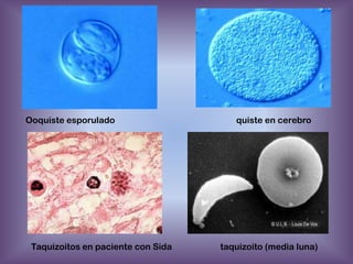 Ooquiste esporulado

Taquizoitos en paciente con Sida

quiste en cerebro

taquizoito (media luna)

 