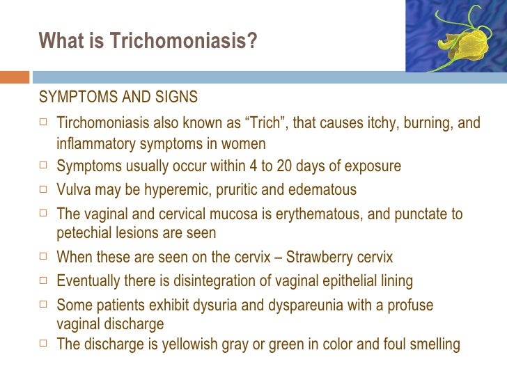 Trichomonas exam