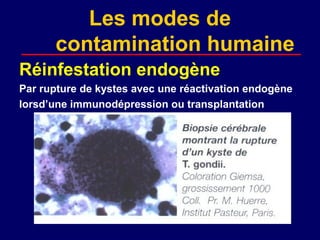Les modes de
      contamination humaine
Réinfestation endogène
Par rupture de kystes avec une réactivation endogène
lorsd’une immunodépression ou transplantation
 