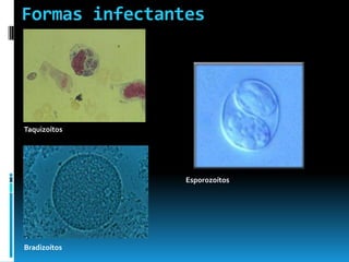 Formas infectantes
Taquizoítos
Esporozoítos
Bradizoítos
 