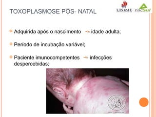 TOXOPLASMOSE PÓS- NATAL


Adquirida após o nascimento



Período de incubação variável;



Paciente imunocompetentes
despercebidas;

idade adulta;

infecções

 