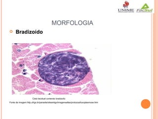 MORFOLOGIA


 Bradizoído

Cisto tecidual contendo bradizoíto
Fonte de imagem:http.ufrgs.br/parasite/siteantigo/imagensatlas/protozoa/toxoplasmose.htm

 