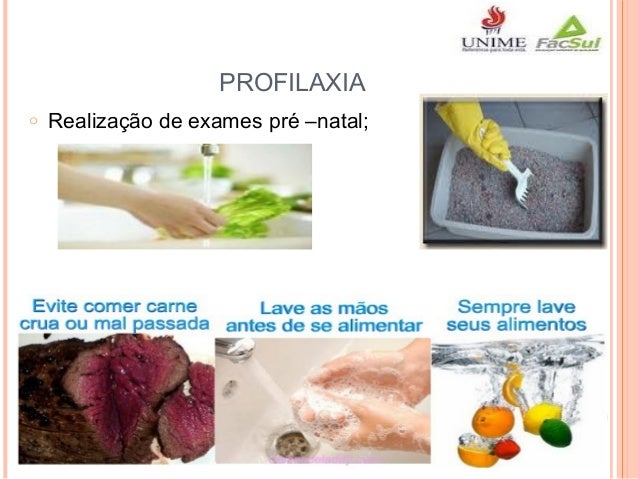 Exames toxoplasmose