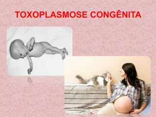 TOXOPLASMOSE CONGÊNITA
 