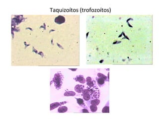 Taquizoítos (trofozoítos)
 