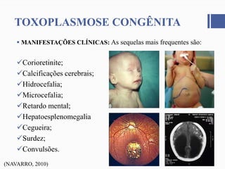  MANIFESTAÇÕES CLÍNICAS: As sequelas mais frequentes são:
Corioretinite;
Calcificações cerebrais;
Hidrocefalia;
Microcefalia;
Retardo mental;
Hepatoesplenomegalia
Cegueira;
Surdez;
Convulsões.
TOXOPLASMOSE CONGÊNITA
(NAVARRO, 2010)
 