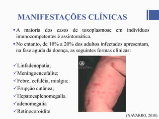 MANIFESTAÇÕES CLÍNICAS
A maioria dos casos de toxoplasmose em indivíduos
imunocompetentes é assintomática.
No entanto, de 10% a 20% dos adultos infectados apresentam,
na fase aguda da doença, as seguintes formas clínicas:
Linfadenopatia;
Meningoencefalite;
Febre, cefaléia, mialgia;
Erupção cutânea;
Hepatoesplenomegalia
adenomegalia
Retinocoroidite
(NAVARRO, 2010)
 