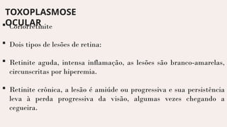 TOXOPLASMOSE
OCULAR
 Coriorretinite
 Dois tipos de lesões de retina:
 Retinite aguda, intensa inflamação, as lesões são branco-amarelas,
circunscritas por hiperemia.
 Retinite crônica, a lesão é amiúde ou progressiva e sua persistência
leva à perda progressiva da visão, algumas vezes chegando a
cegueira.
 