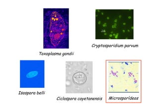 Cryptosporidium parvum
Isospora belli
Ciclospora cayetanensis Microsporídeos
Toxoplasma gondii
 