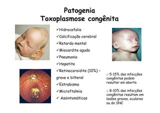 ü Hidrocefalia
ü Calcificação cerebral
ü Retardo mental
ü Miocardite aguda
ü Pneumonia
ü Hepatite
ü Retinocoroidite (10%) –
grave e bilteral
ü Estrabismo
ü Microftalmia
ü  Assintomáticas
Patogenia
Toxoplasmose congênita
o  5-15% das infecções
congênitas podem
resultar em aborto
o  8-10% das infecções
congênitas resultam em
lesões graves, oculares
ou do SNC
 