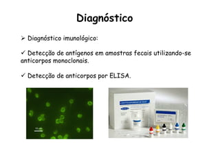 Ø  Diagnóstico imunológico:
ü  Detecção de antígenos em amostras fecais utilizando-se
anticorpos monoclonais.
ü  Detecção de anticorpos por ELISA.
Diagnóstico
 