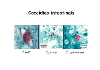 I. belli C. parvum C. cayetanensis
Coccídios intestinais
 