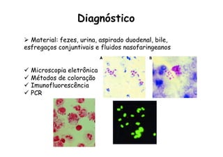 Ø  Material: fezes, urina, aspirado duodenal, bile,
esfregaços conjuntivais e fluidos nasofaringeanos
ü  Microscopia eletrônica
ü  Métodos de coloração
ü  Imunofluorescência
ü  PCR
Diagnóstico
 