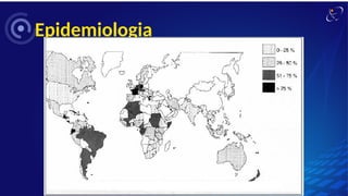 Epidemiologia
 
