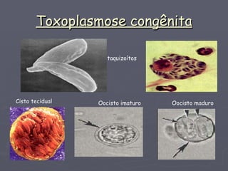 Toxoplasmose congênita taquizoítos Cisto tecidual Oocisto imaturo Oocisto maduro 