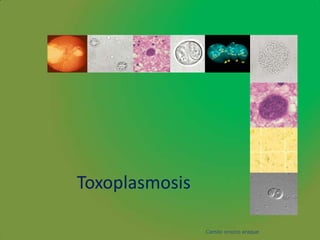 Toxoplasmosis

                Camilo orozco araque
 