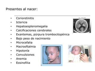 Presentes al nacer:

  •   Corioretinitis
  •   Ictericia
  •   Hepatoesplenomegalia
  •   Calcificaciones cerebrales
  •   Exantemas, púrpura trombocitopénica
  •   Bajo peso de nacimiento
  •   Microcefalia
  •   Macrooftalmia
  •   Hipotonía
  •   Convulsiones
  •   Anemia
  •   Eosinofilia
 